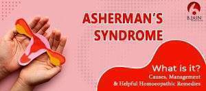 Asherman’s Syndrome- What is it? Causes, Management and helpful Homoeopathic Remedies.