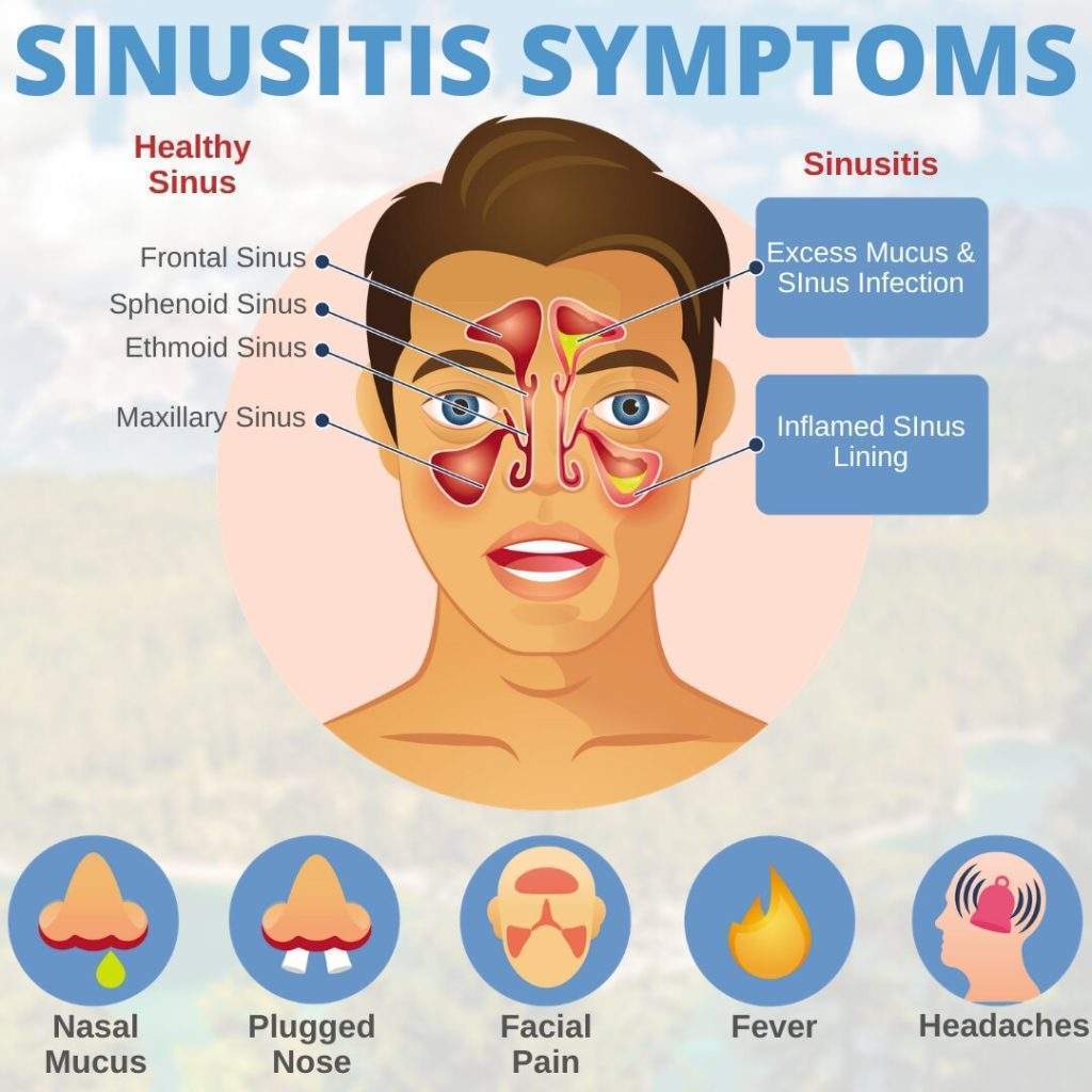 Symptoms of Sinusitis