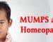 Most Beneficial Homeopathic Remedies for Mumps:
