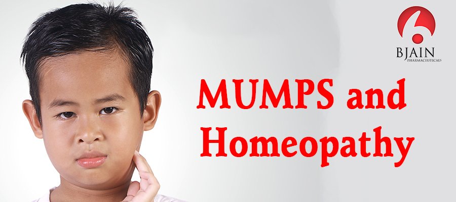 Most Beneficial Homeopathic Remedies for Mumps: