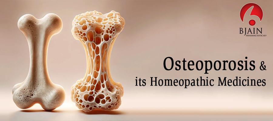 Osteoporosis and Its Homeopathic Remedies