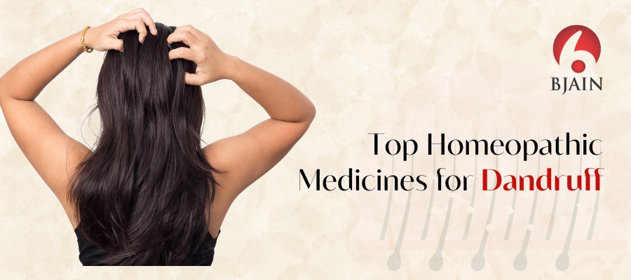 Top Homeopathic Medicines for Dandruff