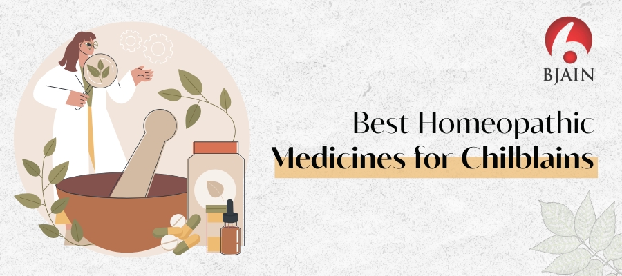 Best Homeopathic Medicines for Chilblains