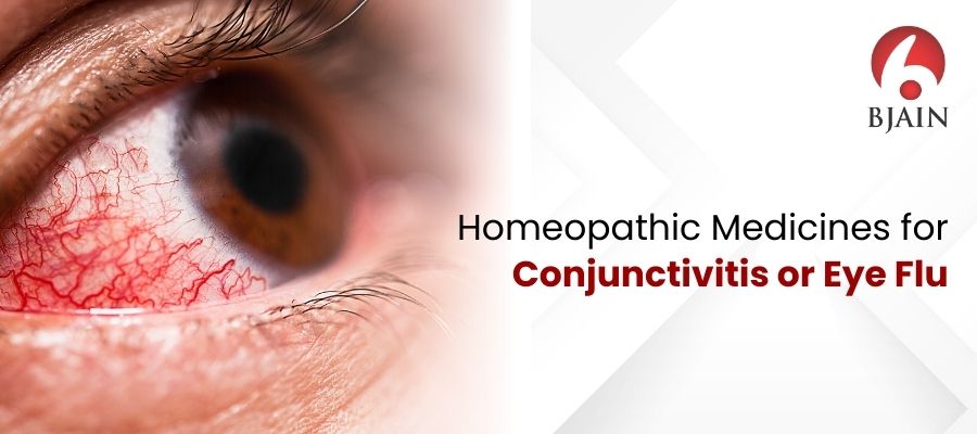 Homeopathic Medicines for Conjunctivitis or Eye Flu