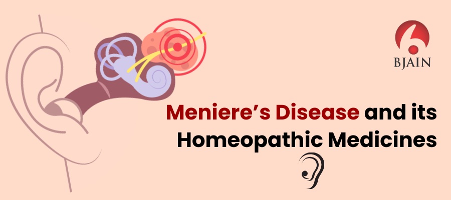 Meniere’s Disease and its Homeopathic Medicines