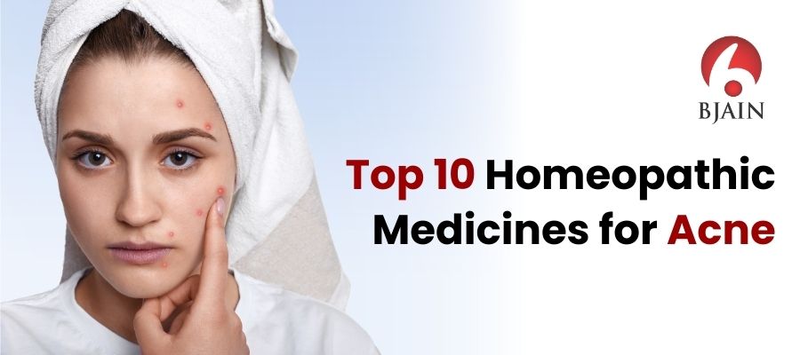 Top 10 Homeopathic Medicines for Acne