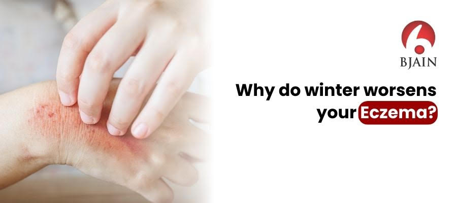 Why do winter worsens your Eczema?